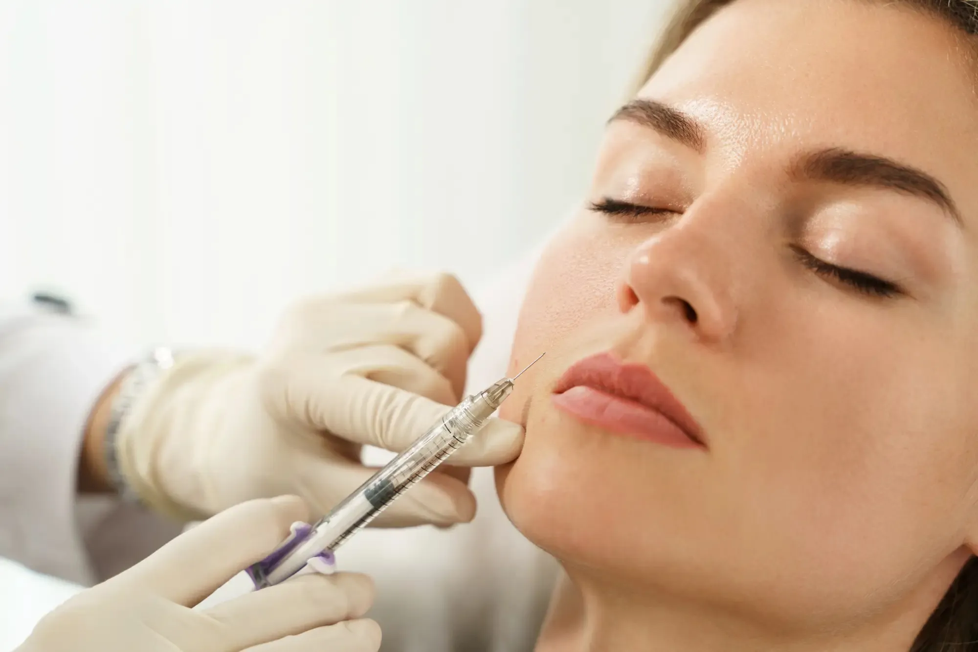 Dermal Fillers Treatment in Laguna Hills, CA | Bella Derm Aesthetic
