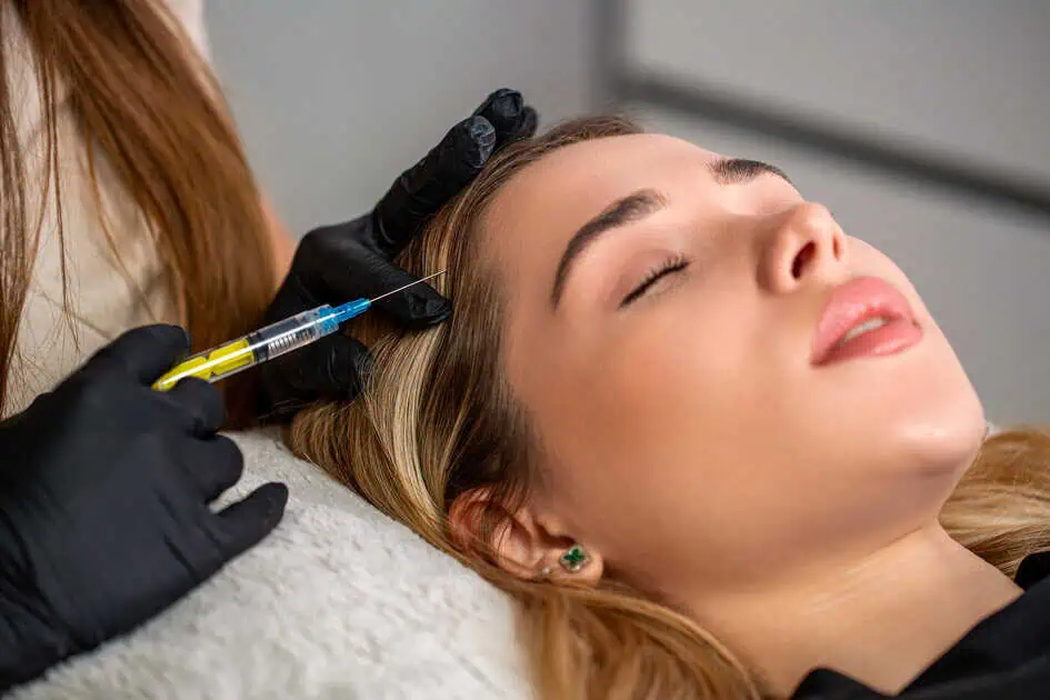 PRP for hair health in Laguna Hills at Bella Derm